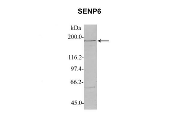SENP6 Rabbit Polyclonal Antibody