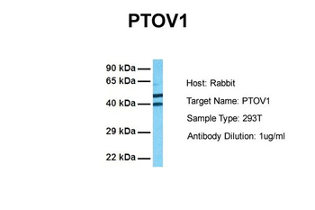 PTOV1 Rabbit Polyclonal Antibody