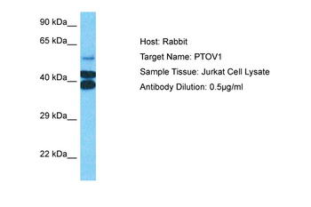PTOV1 Rabbit Polyclonal Antibody