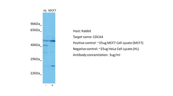 CDCA4 Rabbit Polyclonal Antibody