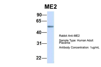 ME2 Rabbit Polyclonal Antibody