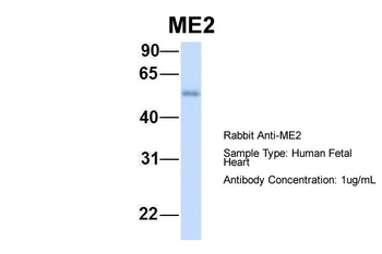 ME2 Rabbit Polyclonal Antibody