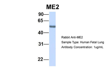 ME2 Rabbit Polyclonal Antibody