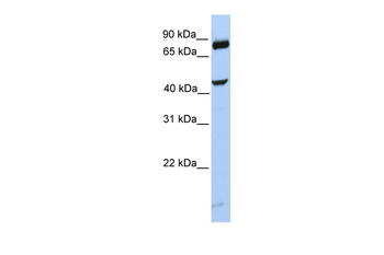 SMYD3 Rabbit Polyclonal Antibody