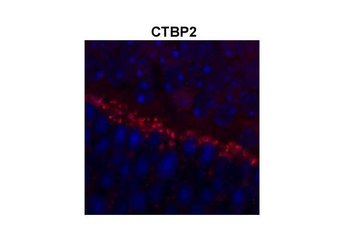 CTBP2 Rabbit Polyclonal Antibody