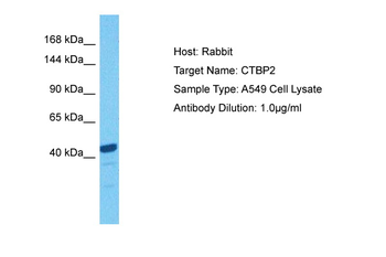CTBP2 Rabbit Polyclonal Antibody