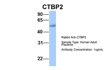 CTBP2 Rabbit Polyclonal Antibody