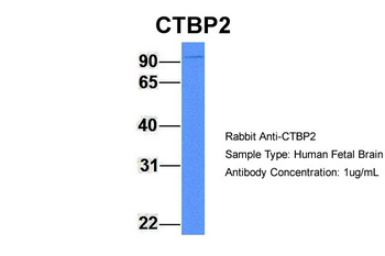 CTBP2 Rabbit Polyclonal Antibody