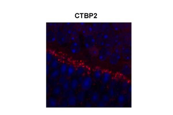CTBP2 Rabbit Polyclonal Antibody