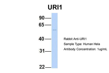 C19orf2 Rabbit Polyclonal Antibody