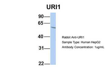 C19orf2 Rabbit Polyclonal Antibody