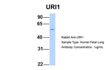 C19orf2 Rabbit Polyclonal Antibody
