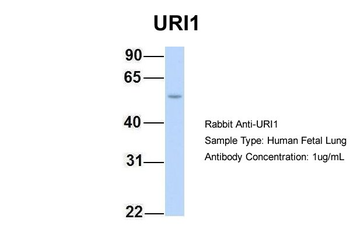 C19orf2 Rabbit Polyclonal Antibody