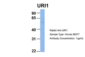 C19orf2 Rabbit Polyclonal Antibody