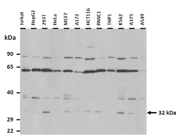 ZMAT3 Rabbit Polyclonal Antibody