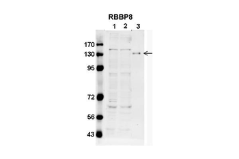 RBBP8 Rabbit Polyclonal Antibody