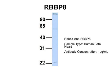 RBBP8 Rabbit Polyclonal Antibody