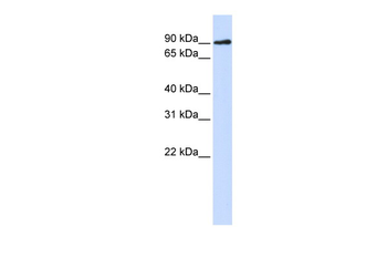 DCLRE1C Rabbit Polyclonal Antibody