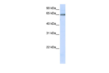 DCLRE1C Rabbit Polyclonal Antibody