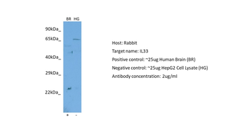 IL33 Rabbit Polyclonal Antibody