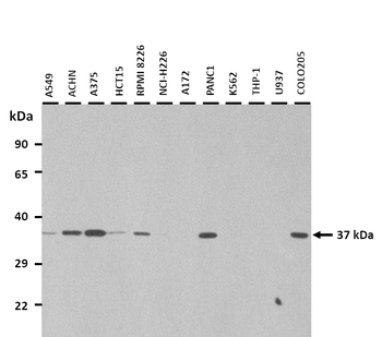 MAS1 Rabbit Polyclonal Antibody