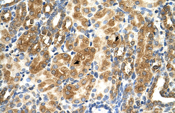 MAS1 Rabbit Polyclonal Antibody