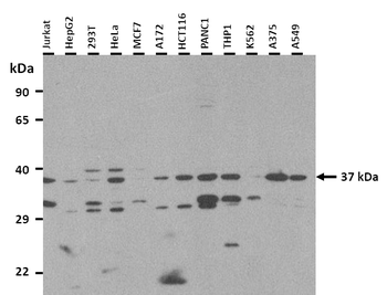 MAS1 Rabbit Polyclonal Antibody