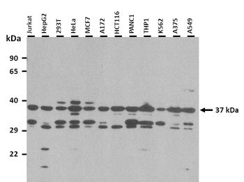 MAS1 Rabbit Polyclonal Antibody