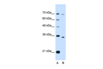 PHF6 Rabbit Polyclonal Antibody