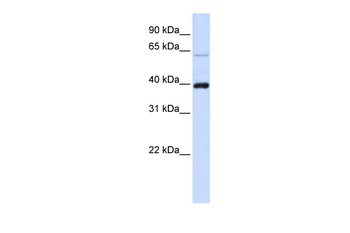 PHF6 Rabbit Polyclonal Antibody