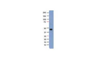 PHF6 Rabbit Polyclonal Antibody