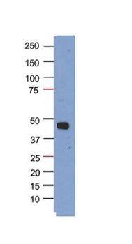 PHF6 Rabbit Polyclonal Antibody