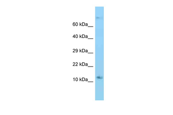 Rps12 Rabbit Polyclonal Antibody
