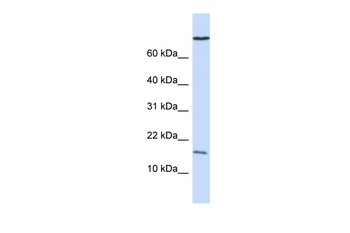 GABARAP Rabbit Polyclonal Antibody