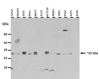 TNNI2 Rabbit Polyclonal Antibody
