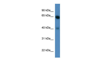 NTRK2 Rabbit Polyclonal Antibody