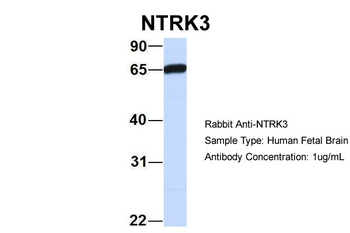 NTRK3 Rabbit Polyclonal Antibody