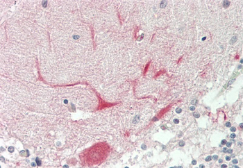 NTRK3 Rabbit Polyclonal Antibody