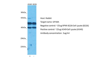 GP1BA Rabbit Polyclonal Antibody