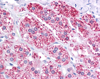 ABCB1 Rabbit Polyclonal Antibody