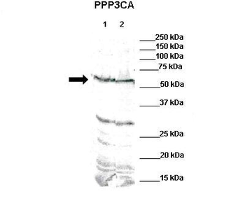 PPP3CA Rabbit Polyclonal Antibody