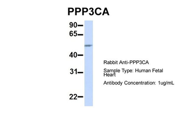 PPP3CA Rabbit Polyclonal Antibody