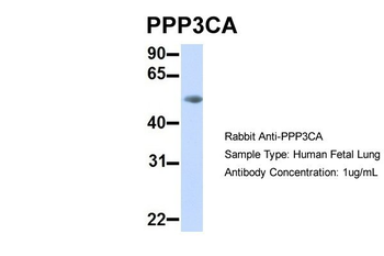 PPP3CA Rabbit Polyclonal Antibody