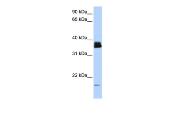 PPIA Rabbit Polyclonal Antibody