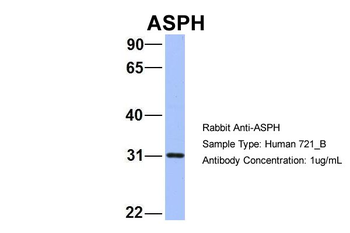 ASPH Rabbit Polyclonal Antibody