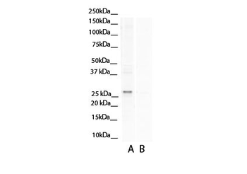 ASPH Rabbit Polyclonal Antibody