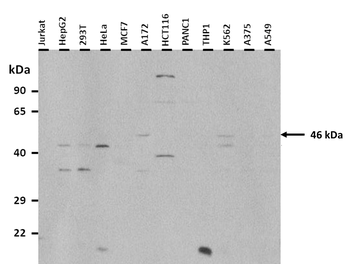 OAS1 Rabbit Polyclonal Antibody