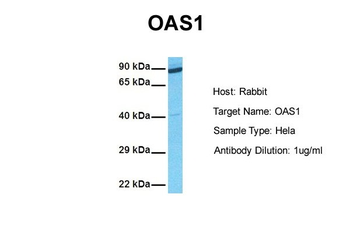 OAS1 Rabbit Polyclonal Antibody