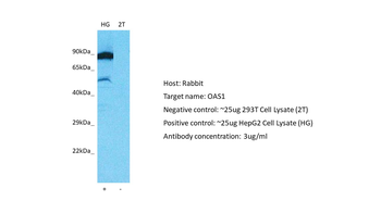 OAS1 Rabbit Polyclonal Antibody