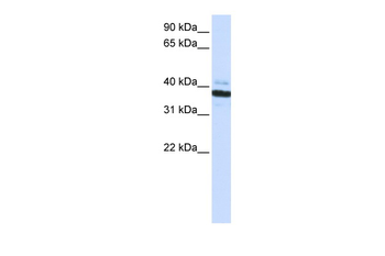 OAS1 Rabbit Polyclonal Antibody